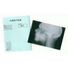 MS030 - Skull X-ray